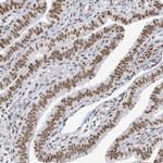 STAG1 Antibody in Immunohistochemistry (Paraffin) (IHC (P))