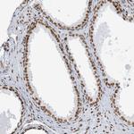 STAG1 Antibody in Immunohistochemistry (Paraffin) (IHC (P))
