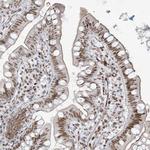 STAG1 Antibody in Immunohistochemistry (Paraffin) (IHC (P))