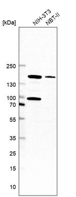 STAG1 Antibody in Western Blot (WB)