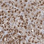 BPOZ Antibody in Immunohistochemistry (Paraffin) (IHC (P))