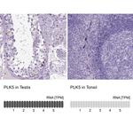 PLK5 Polyclonal Antibody