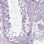PLK5 Antibody in Immunohistochemistry (IHC)
