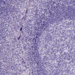 PLK5 Antibody in Immunohistochemistry (IHC)