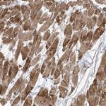 KLH18 Antibody in Immunohistochemistry (Paraffin) (IHC (P))