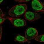 KLH18 Antibody in Immunocytochemistry (ICC/IF)