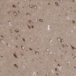 KLH18 Antibody in Immunohistochemistry (Paraffin) (IHC (P))