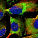 EEF1B2 Polyclonal Antibody