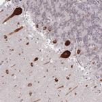 EEF1B2 Antibody in Immunohistochemistry (IHC)