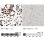 Grancalcin Antibody in Immunohistochemistry (IHC)