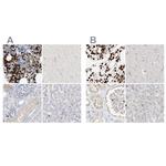 Grancalcin Antibody in Immunohistochemistry (IHC)