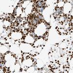 Grancalcin Antibody in Immunohistochemistry (IHC)