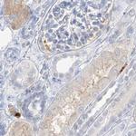 Grancalcin Antibody in Immunohistochemistry (IHC)