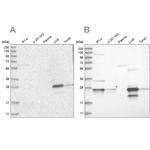 Grancalcin Antibody in Western Blot (WB)