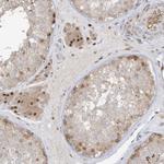 ZCWPW2 Polyclonal Antibody