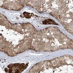 PLEKHM3 Antibody in Immunohistochemistry (Paraffin) (IHC (P))
