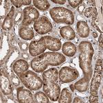 ETAA1 Polyclonal Antibody