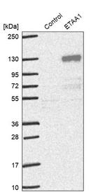 ETAA1 Antibody in Western Blot (WB)