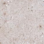 ETAA1 Polyclonal Antibody