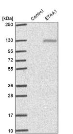 ETAA1 Antibody in Western Blot (WB)