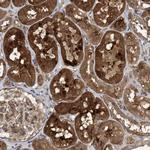 HS1BP3 Antibody in Immunohistochemistry (Paraffin) (IHC (P))