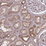 GRB14 Antibody in Immunohistochemistry (Paraffin) (IHC (P))