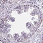 GRB14 Antibody in Immunohistochemistry (Paraffin) (IHC (P))