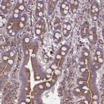 GRB14 Polyclonal Antibody