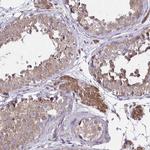 GRB14 Antibody in Immunohistochemistry (Paraffin) (IHC (P))