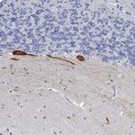 Neurotrypsin Polyclonal Antibody