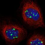 MPP10 Polyclonal Antibody