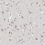 MPP10 Antibody in Immunohistochemistry (IHC)