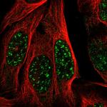 MAST3 Polyclonal Antibody