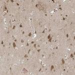 MAST3 Antibody in Immunohistochemistry (Paraffin) (IHC (P))