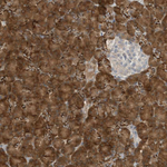 MAST3 Antibody in Immunohistochemistry (Paraffin) (IHC (P))