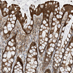 MAST3 Antibody in Immunohistochemistry (Paraffin) (IHC (P))