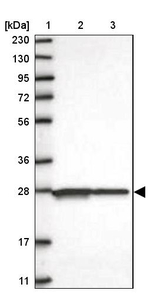 C11orf73 Antibody in Western Blot (WB)