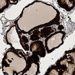 C11orf73 Polyclonal Antibody