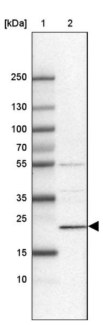 C11orf73 Antibody in Western Blot (WB)