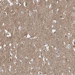 ABHD7 Antibody in Immunohistochemistry (Paraffin) (IHC (P))