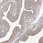 ABHD7 Antibody in Immunohistochemistry (Paraffin) (IHC (P))
