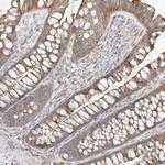 ABHD7 Antibody in Immunohistochemistry (Paraffin) (IHC (P))