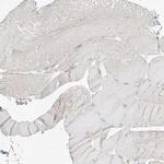 ABHD7 Antibody in Immunohistochemistry (Paraffin) (IHC (P))
