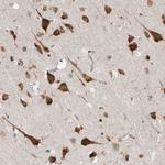 UBAP2L Antibody in Immunohistochemistry (Paraffin) (IHC (P))