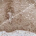 TTC22 Polyclonal Antibody