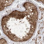 TBCC Antibody in Immunohistochemistry (IHC)