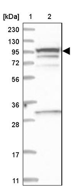 SCARF2 Antibody in Western Blot (WB)