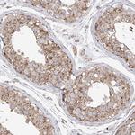 XKR3 Polyclonal Antibody