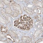 VAMP5 Antibody in Immunohistochemistry (Paraffin) (IHC (P))
