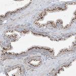 VAMP5 Antibody in Immunohistochemistry (Paraffin) (IHC (P))